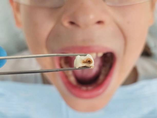 Best Broken or Chipped Tooth Repair in Ivyland, PA